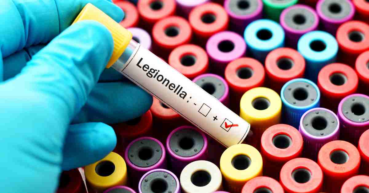 Legionella - Test