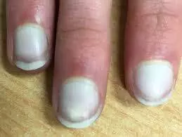 Białe paznokcie