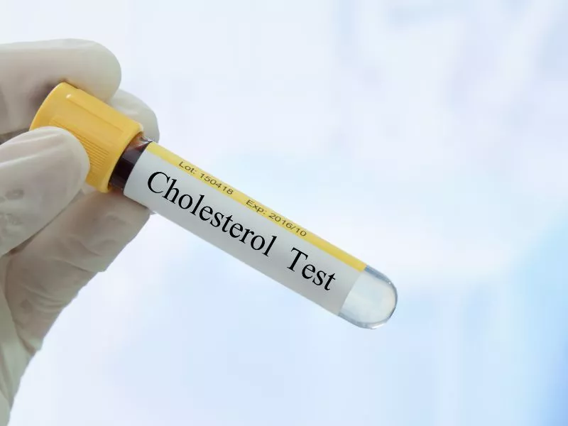 Cholesterol - Jak walczyć z jego nadmiarem we krwi?