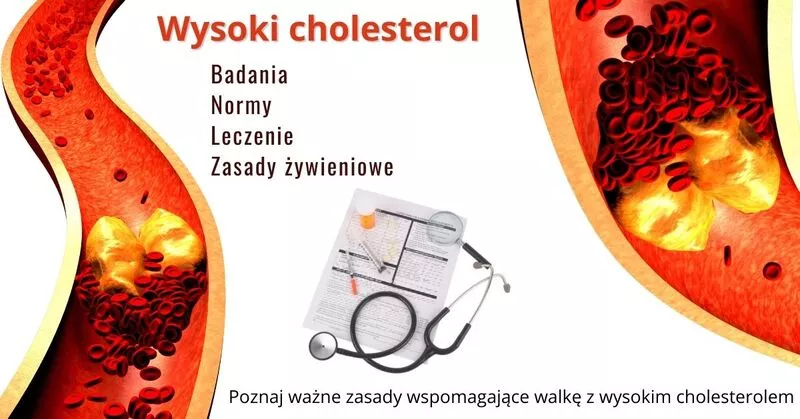 Cholesterol - Co warto o nim wiedzieć?