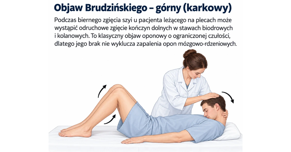 Objaw Brudzińskiego (karkowy)