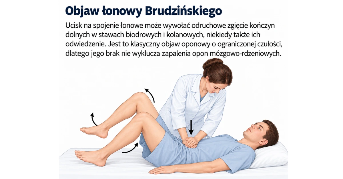 Objaw Brudzińskiego (łonowy)
