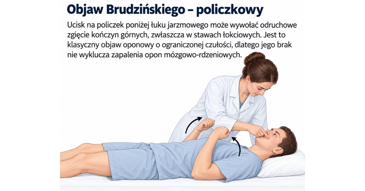 Objaw Brudzińskiego (policzkowy)