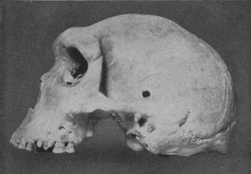 Prehistoryczna czaszka z raną postrzałową zadaną bronią palną