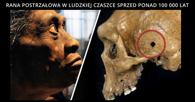 Prehistoryczna czaszka z bardzo tajemniczym otworem