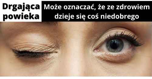Drgająca powieka - Przyczyny drgającej powieki