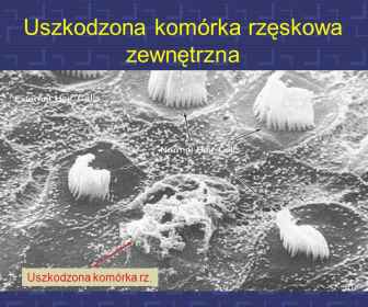 Komórki rzęskowe