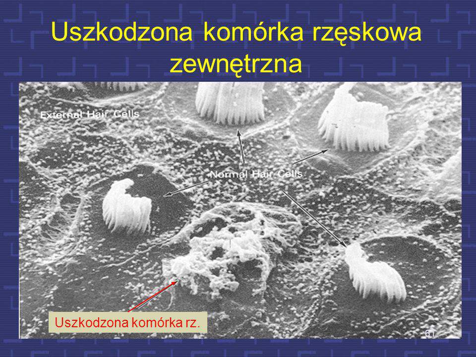 Szumu i dzwonienie w uszach - Komórki rzęskowe