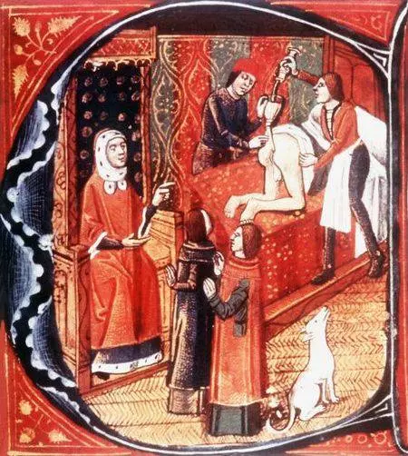 Lewatywa w średniowieczu