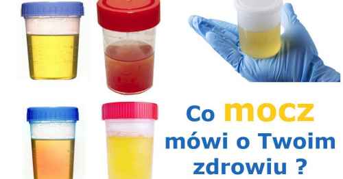 Co mocz mówi o Twoim zdrowiu?