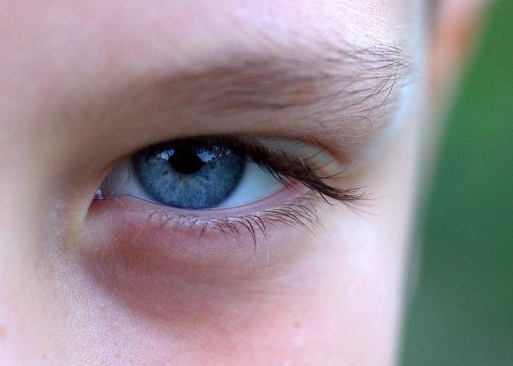 Barwa oczu a podatność na choroby