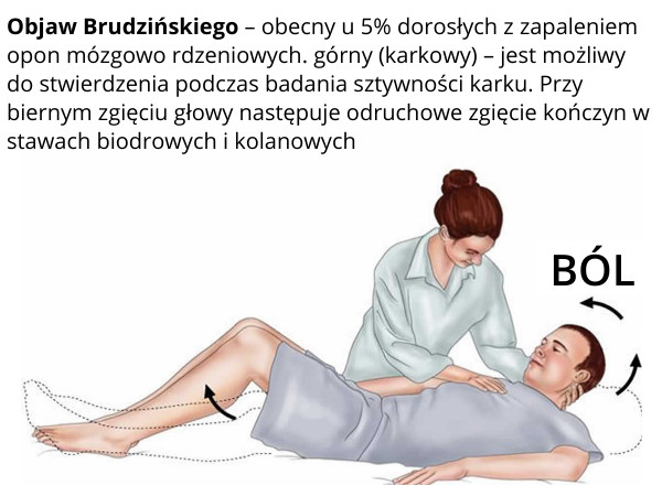Objawy zapalenia opon mózgowych - Objaw Brudzińskiego