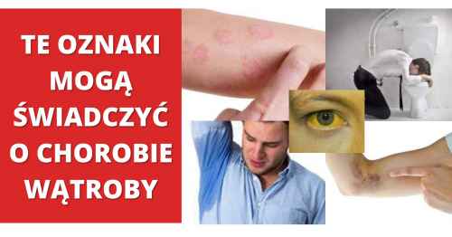 Typowe objawy chorej wątroby