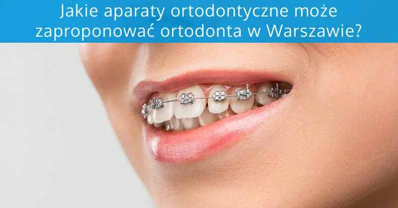 Aparaty ortodontyczne Warszawa