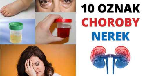 Oznaki chorych nerek