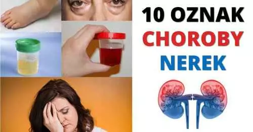 Oznaki chorych nerek
