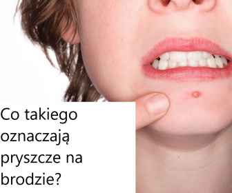 Pryszcze na twarzy - Co oznaczają pryszcze na brodzie?