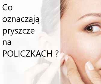 Pryszcze na policzkach - Co oznaczają?