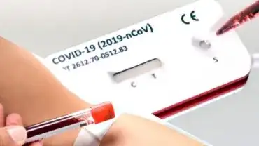 Test na COVID