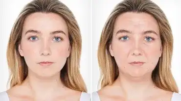 Niezdrowa dieta zrujnuje Twoją urodę