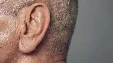 Czy nietypowy wygląd płatka ucha może oznaczać chorobę serca?