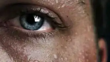 Nadmierna potliwość - Co może oznaczać?