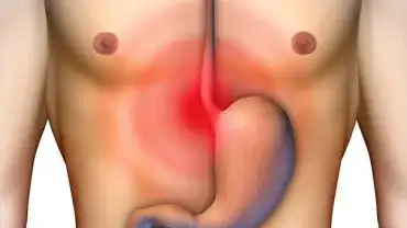 Żołądek - Leki na zgagę mogą szkodzić zdrowiu