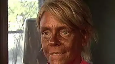 Czy solarium jest bezpieczne dla skóry?