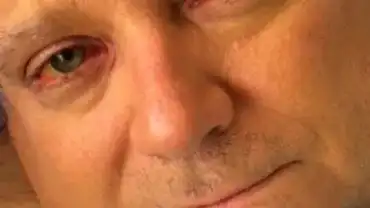 Niebezpieczne suplementy diety