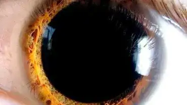 Choroby widoczne w oczach