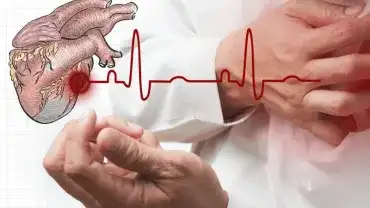 Cichy zawał serca - Jakie daje objawy? Jak rozpoznać?