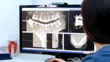 Niezdrowe i nieleczone zęby mogą być przyczyną ciężkich chorób ogólnoustrojowych