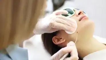 Laserowe usuwanie kurzajek