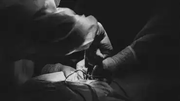 Operacja usuwania przepukliny kręgosłupa