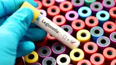 Legionella - Test