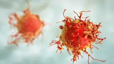 Badanie prostaty - Biopsia fuzyjna w Warszawie