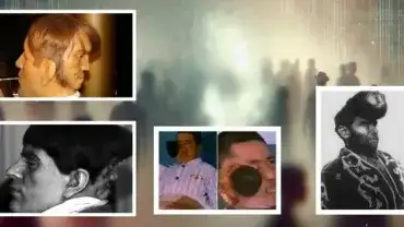 Rzadkie przypadki osób urodzonych z dwoma twarzami