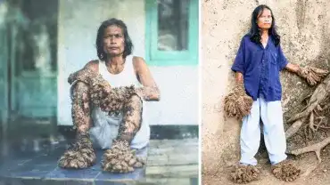 Przypadek Dede Koswara