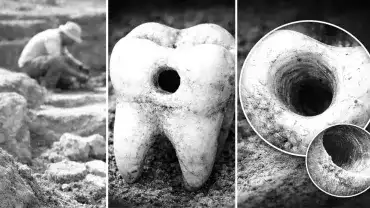 Stomatologia sprzed 9000 lat? Jak to możliwe