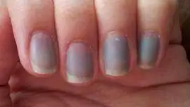Niebieskawe paznokcie