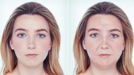 Jak niezdrowa dieta wpływa na wygląd twarzy?