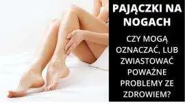 Pajączki na nogach - Czy mogą zwiastować poważne choroby?