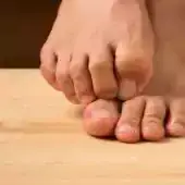 Swędzące stopy